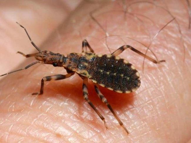 Chagas